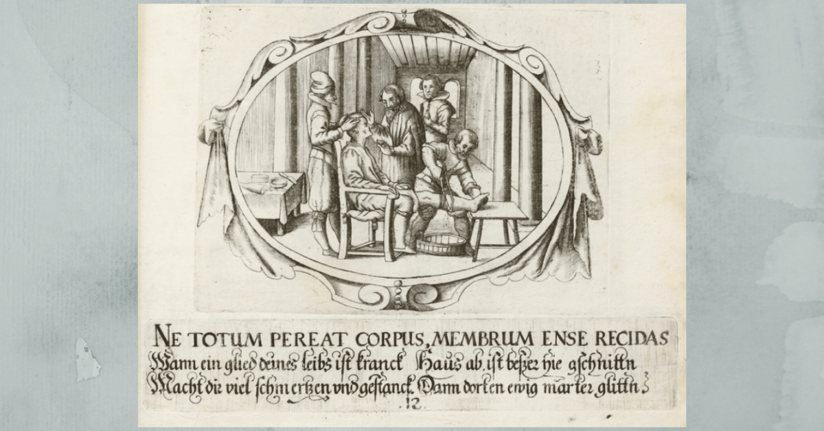 Jacque Guillemeau's Le chirvrgie françoise recueillie des antiens médecins et chirurgiens